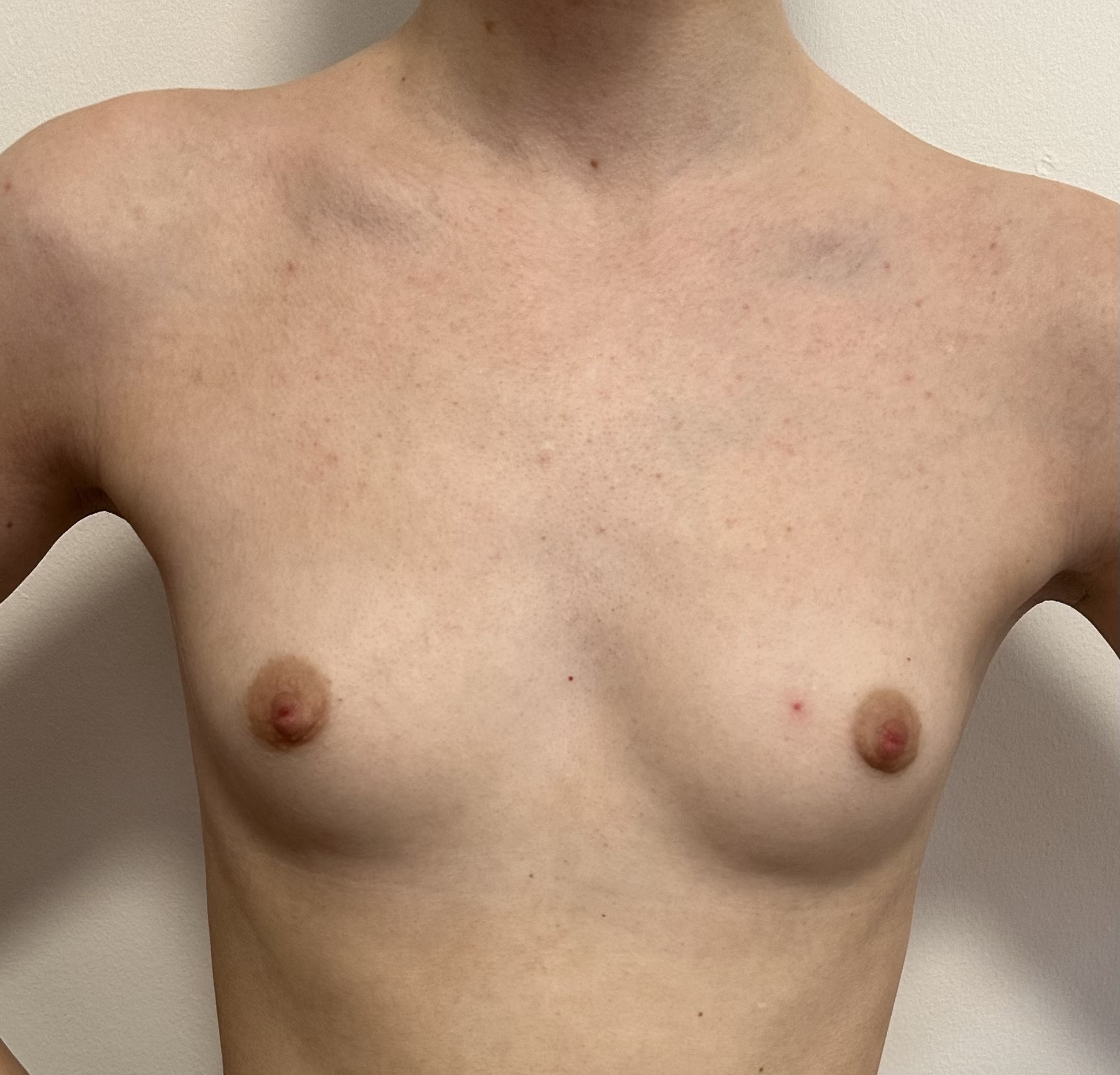 Before — GC 175 SM